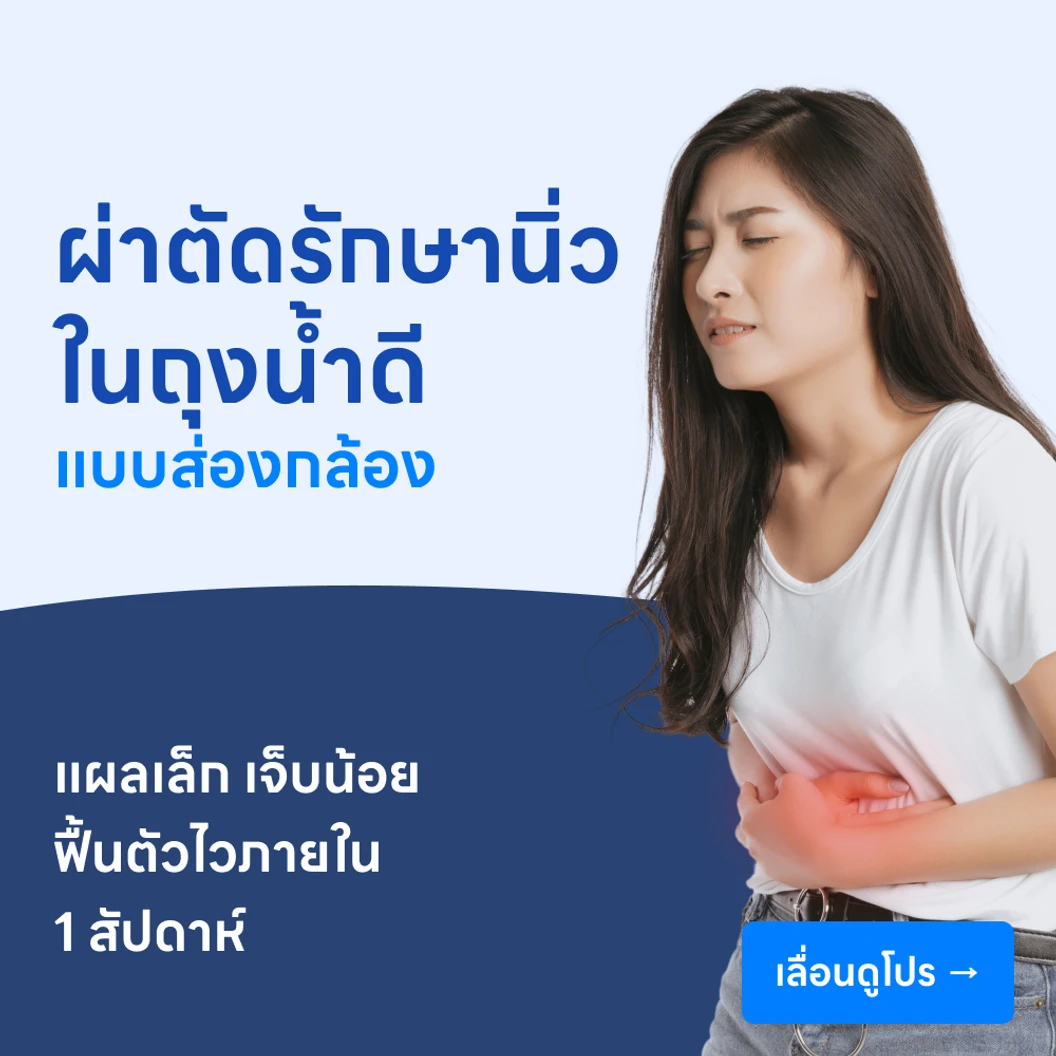 ผ่าตัดนิ่วในถุงน้ำดี (แบบส่องกล้อง)