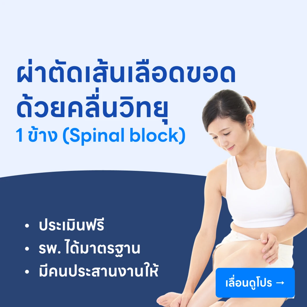 ผ่าตัดเส้นเลือดขอดด้วยคลื่นวิทยุ 1 ข้าง (Spinal block)