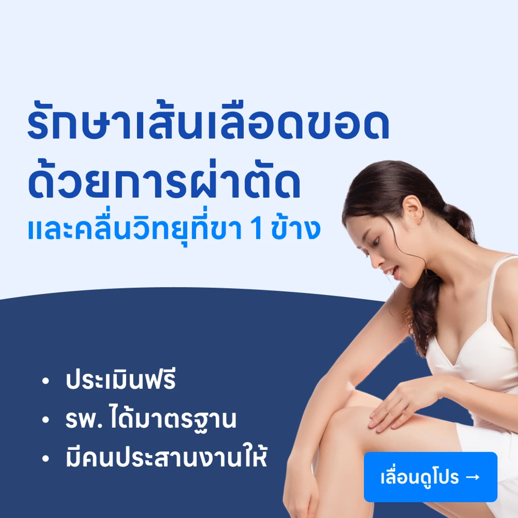 ผ่าตัดเส้นเลือดขอดด้วยคลื่นวิทยุ ร่วมกับผ่าตัดกำจัดเส้นเลือดขอดบริเวณขา 1 ข้าง