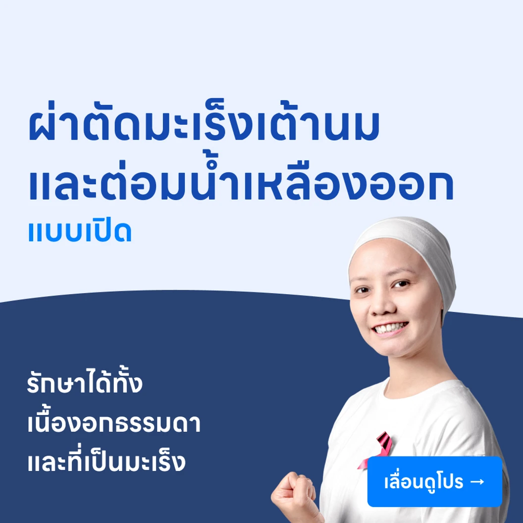 ผ่าตัดมะเร็งเต้านม พร้อมตัดต่อมน้ำเหลืองออก (แบบเปิด)