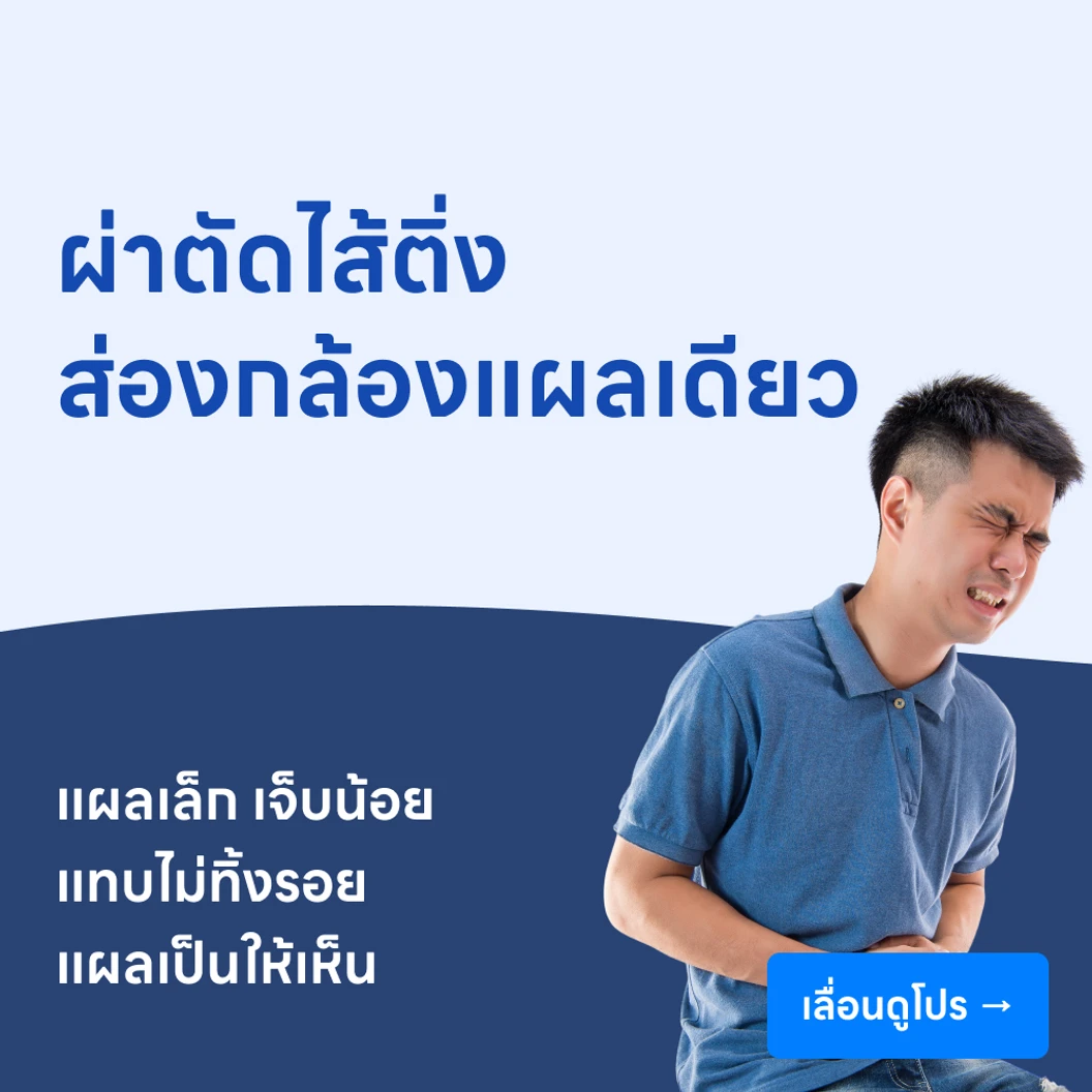 ผ่าตัดไส้ติ่ง (แบบส่องกล้องแผลเดียว)