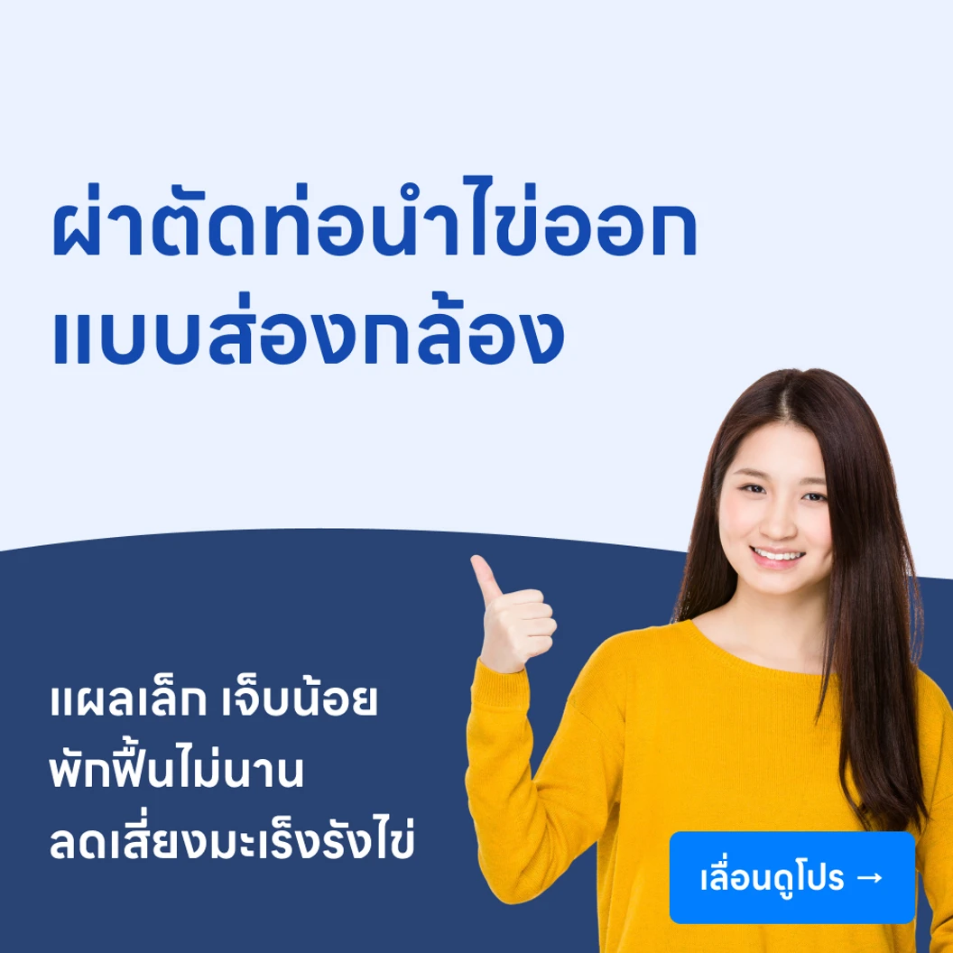 ผ่าตัดท่อนำไข่ออก (แบบส่องกล้อง)