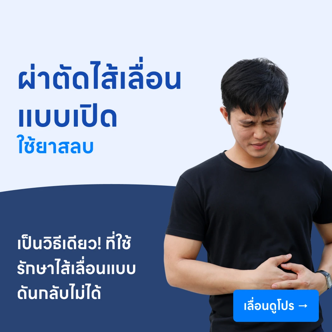 ผ่าตัดไส้เลื่อน (แบบเปิด) // ใช้ยาสลบ