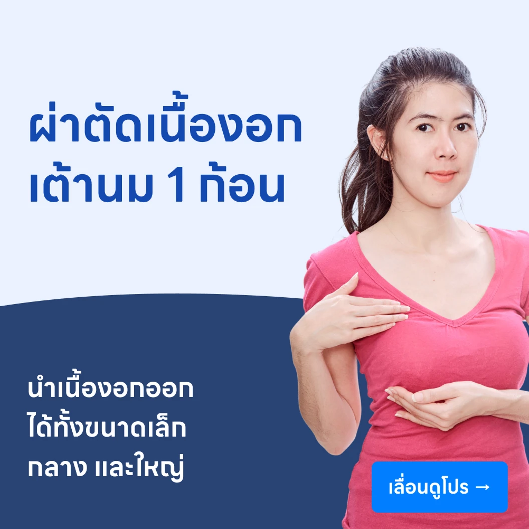 ผ่าตัดเนื้องอกเต้านม