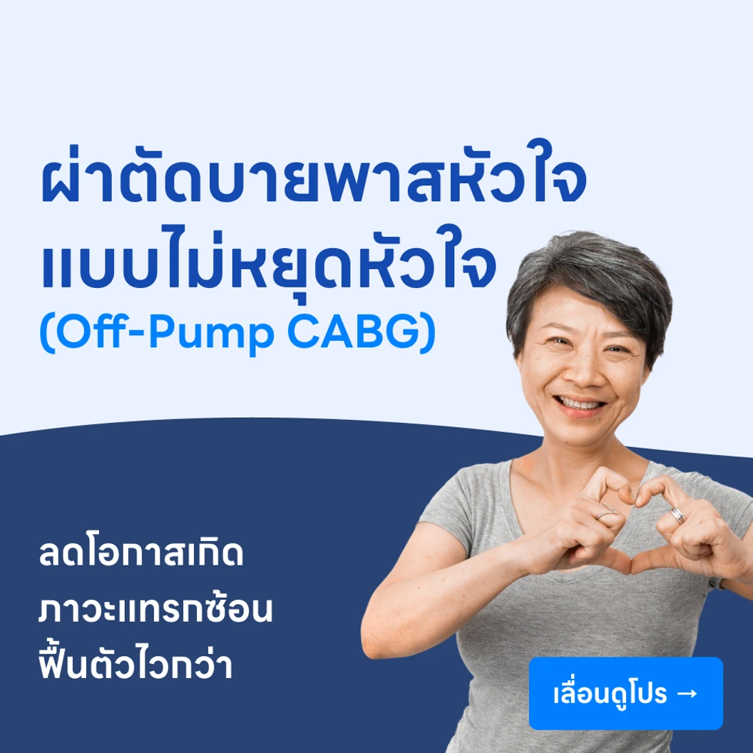 ผ่าตัดบายพาสหัวใจ เทคนิคหัวใจไม่หยุดเต้น (Off-Pump CABG)