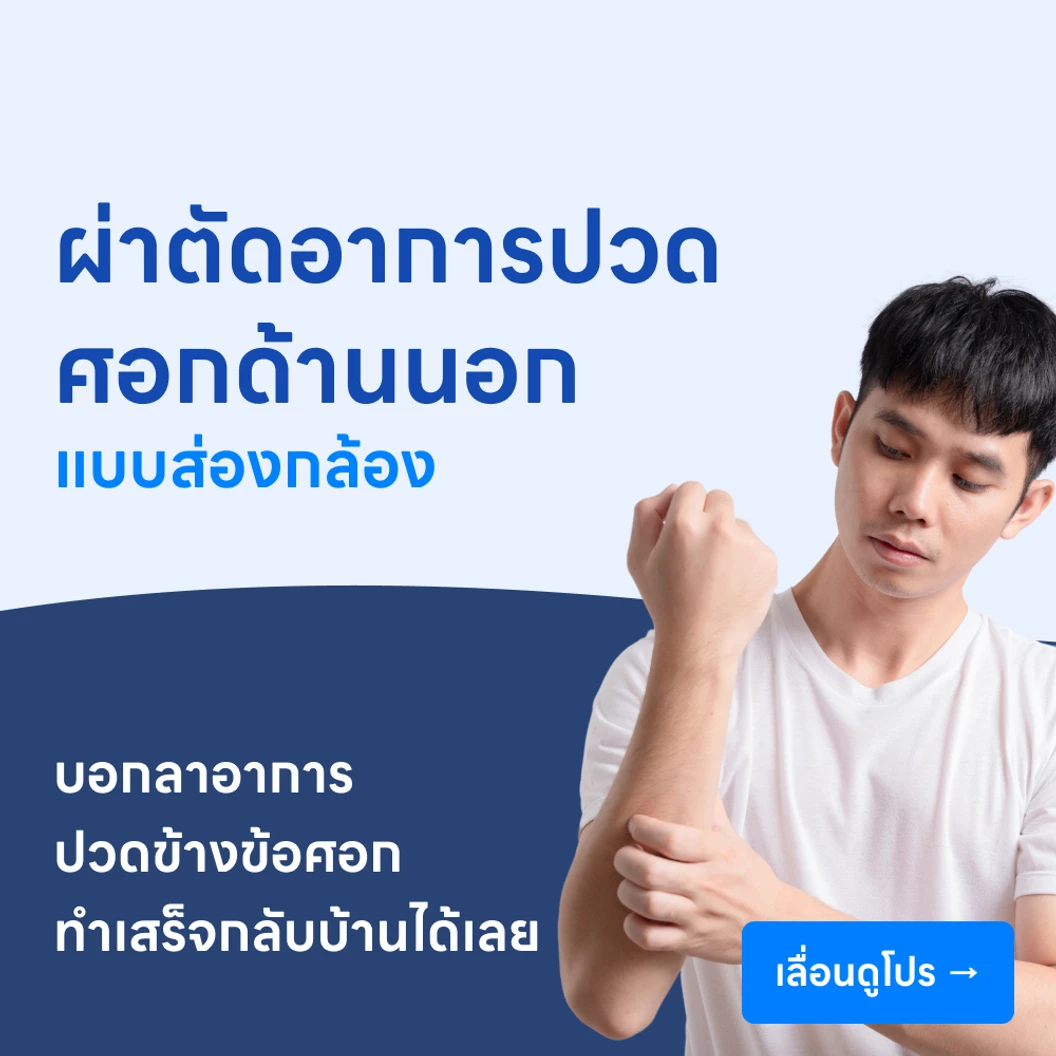 ผ่าตัดรักษาอาการปวดศอกด้านนอก (Tennis Elbow) (แบบส่องกล้อง)