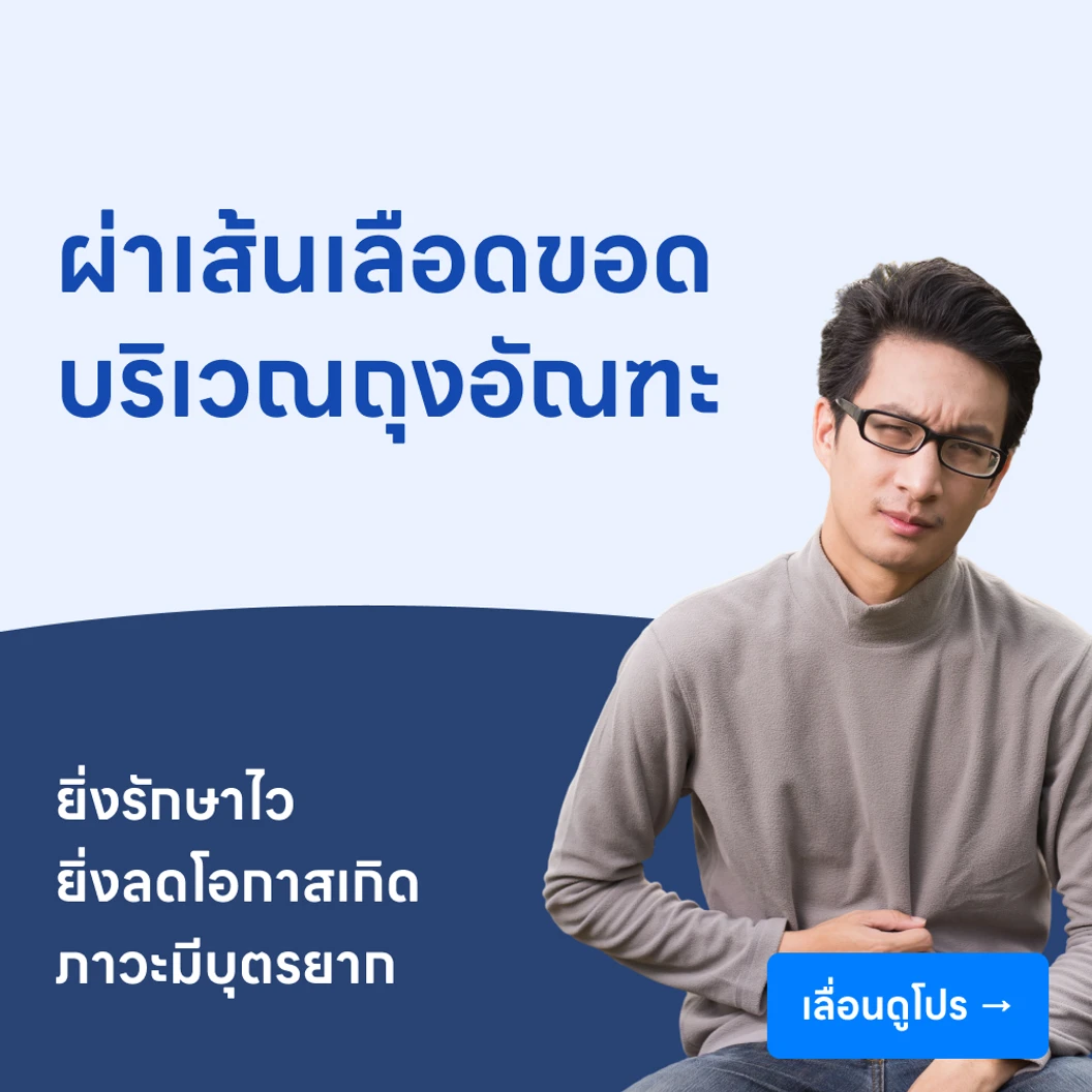 ผ่าตัดเส้นเลือดขอดที่อัณฑะ