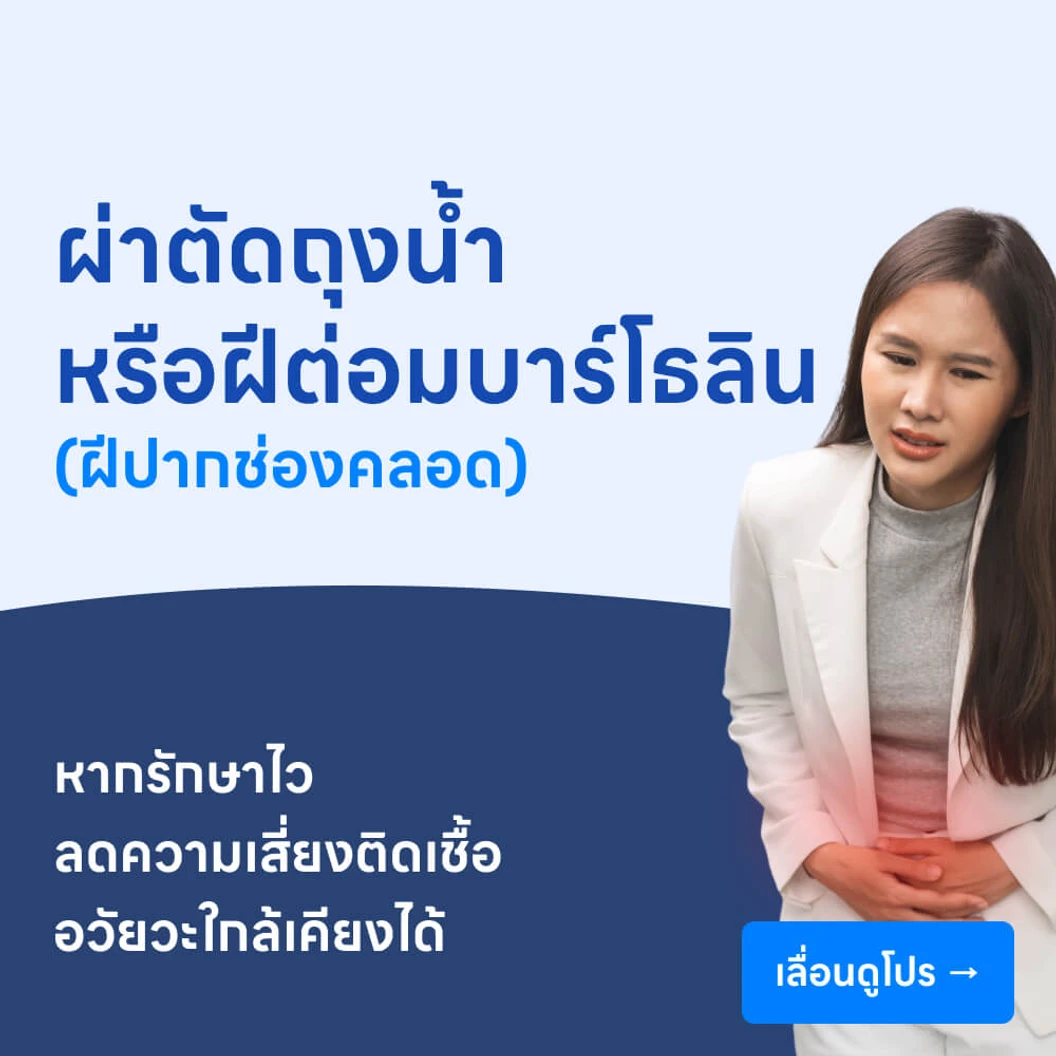 ผ่าถุงน้ำหรือฝีต่อมบาร์โธลิน (ฝีปากช่องคลอดหรือฝีอวัยวะเพศหญิง)