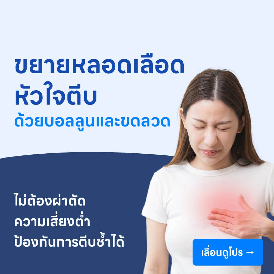 ขยายหลอดเลือดหัวใจตีบด้วยบอลลูนและการดามขดลวด (PCI หรือ PTCA & Stent)