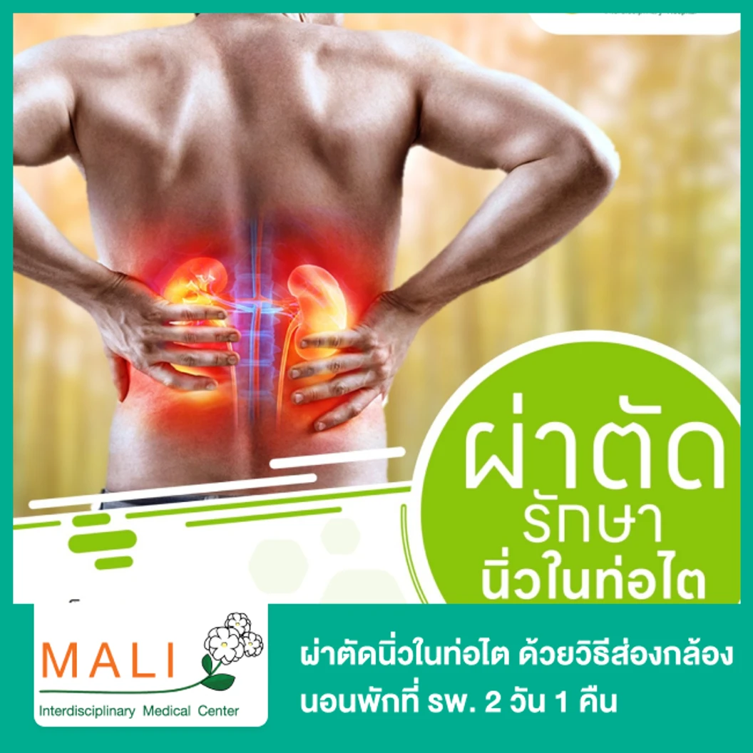 ผ่าตัดนิ่วในท่อไต ด้วยวิธีส่องกล้อง (Ureterolithotomy) นอนพักที่ รพ. 2 วัน 1 คืน