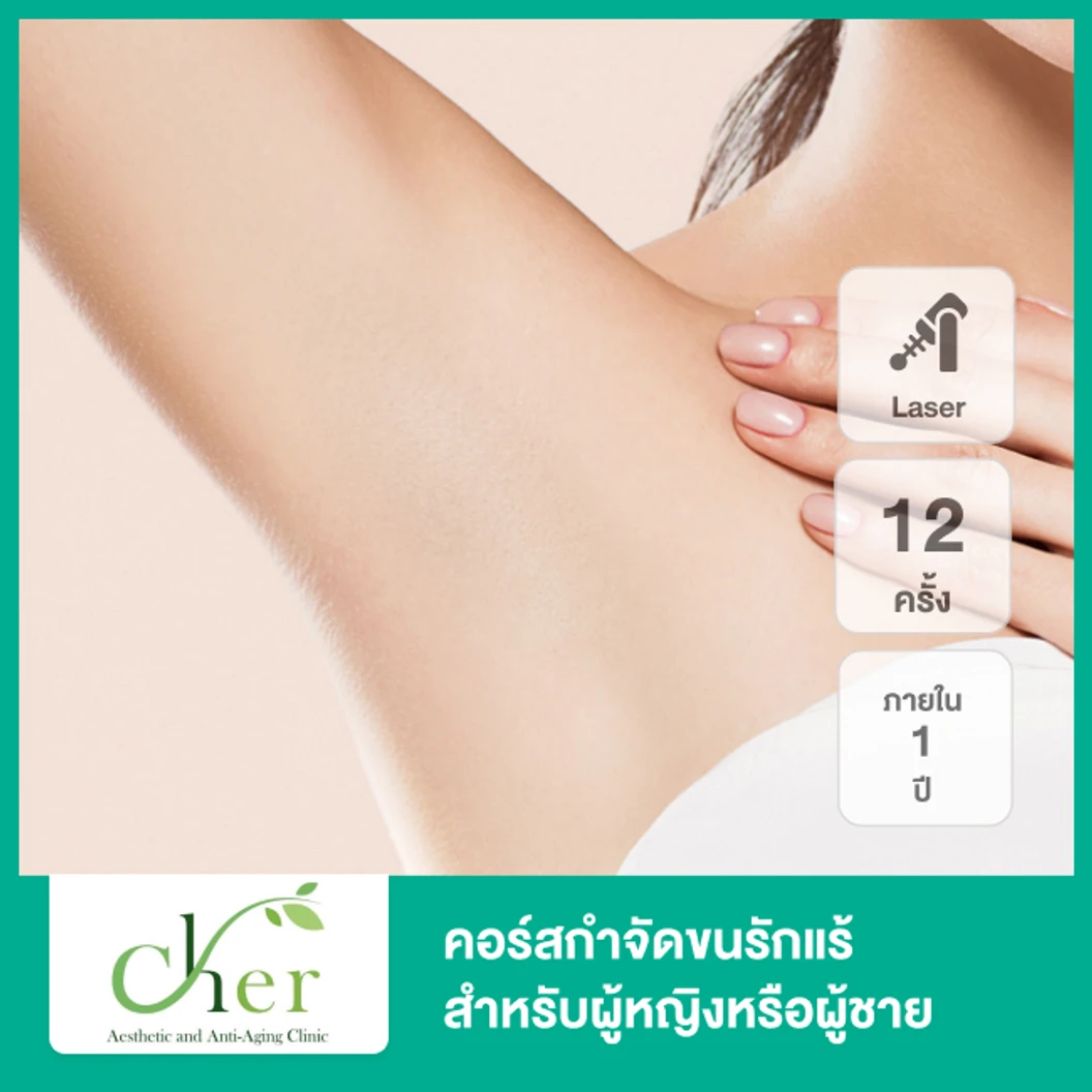 คอร์สกำจัดขนรักแร้ ด้วย Diode Laser 12 ครั้ง ภายใน 1 ปี สำหรับผู้หญิงเท่านั้น (เฉพาะสาขาที่กำหนด) สำหรับเคสทำครั้งแรก