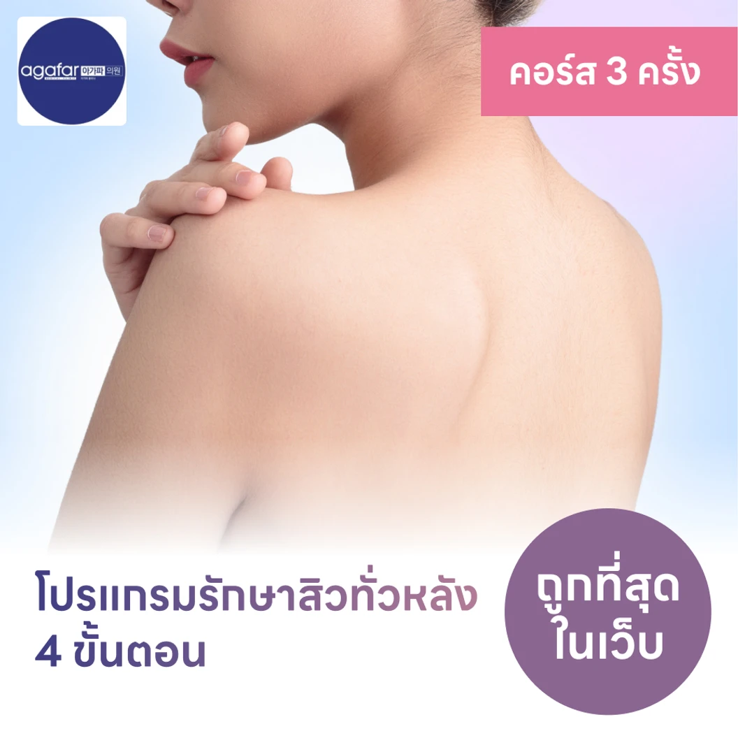 โปรแกรมรักษาสิวทั่วแผ่นหลัง 4 ขั้นตอน 2 ครั้ง ฟรี! 1 ครั้ง