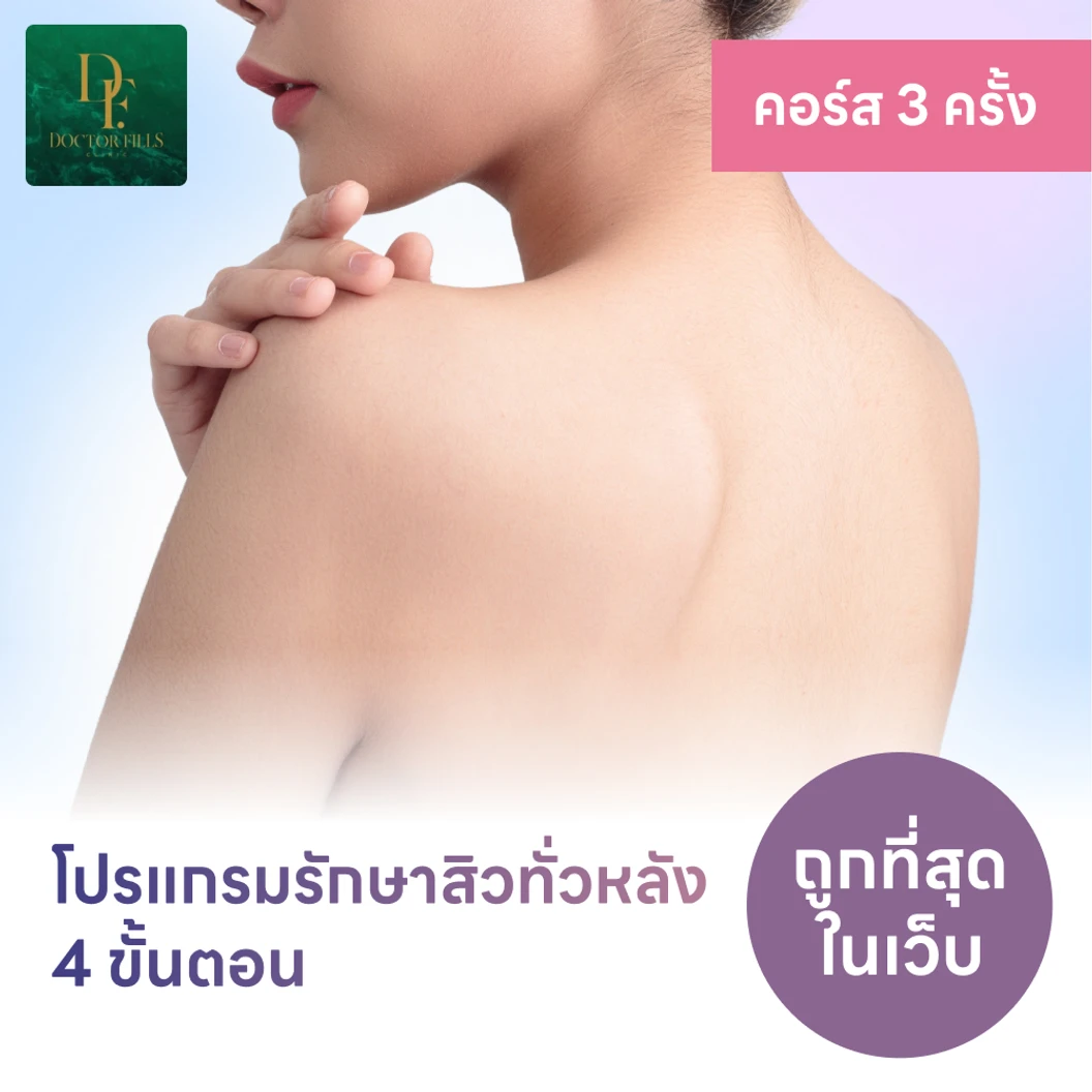 โปรแกรมรักษาสิวทั่วแผ่นหลัง 4 ขั้นตอน 2 ครั้ง ฟรี! 1 ครั้ง