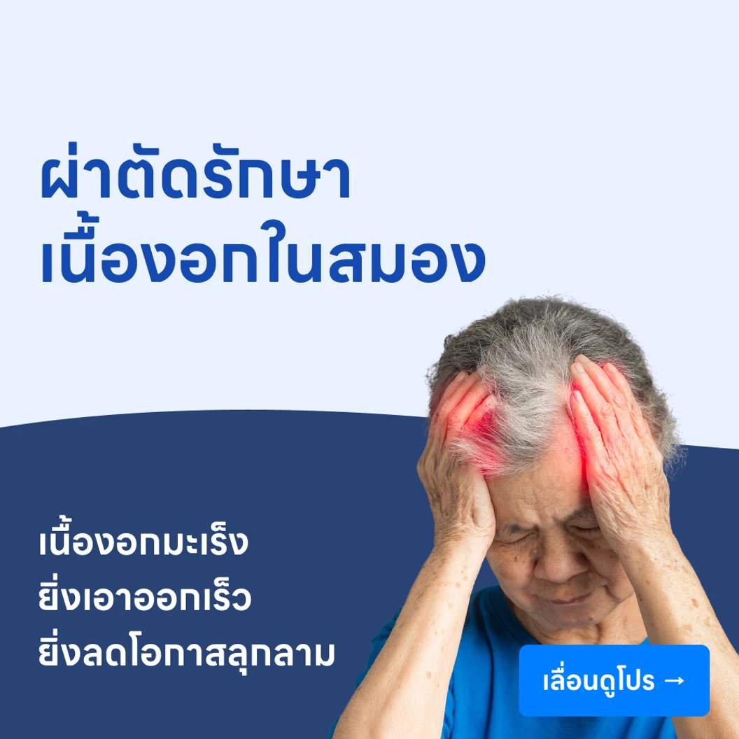 ผ่าตัดรักษาเนื้องอกสมอง