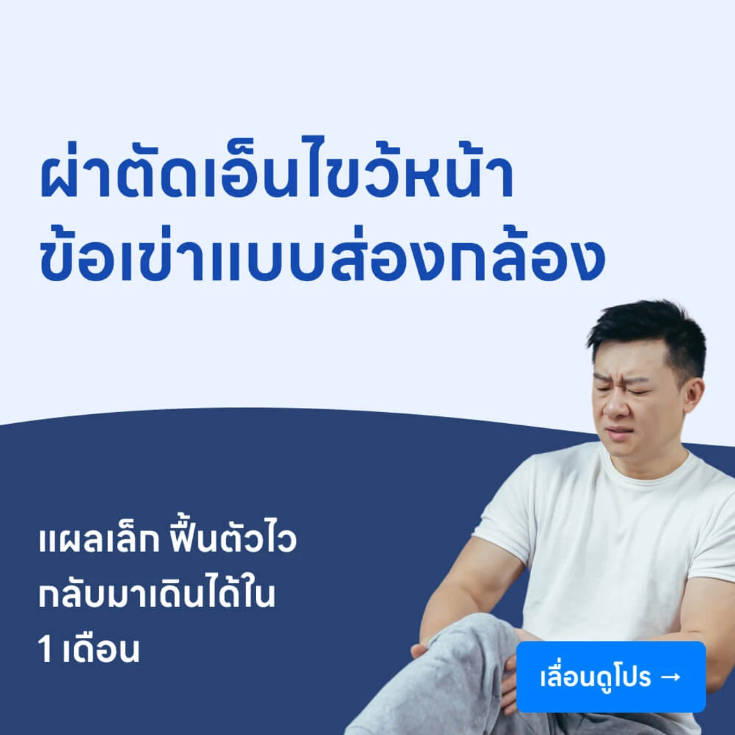 ผ่าตัดเอ็นไขว้หน้าเข่า ACL (แบบส่องกล้อง)