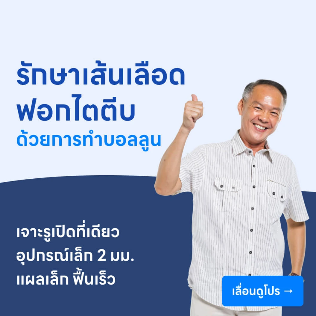 รักษาเส้นเลือดฟอกไตตีบ ด้วยการทำบอลลูน