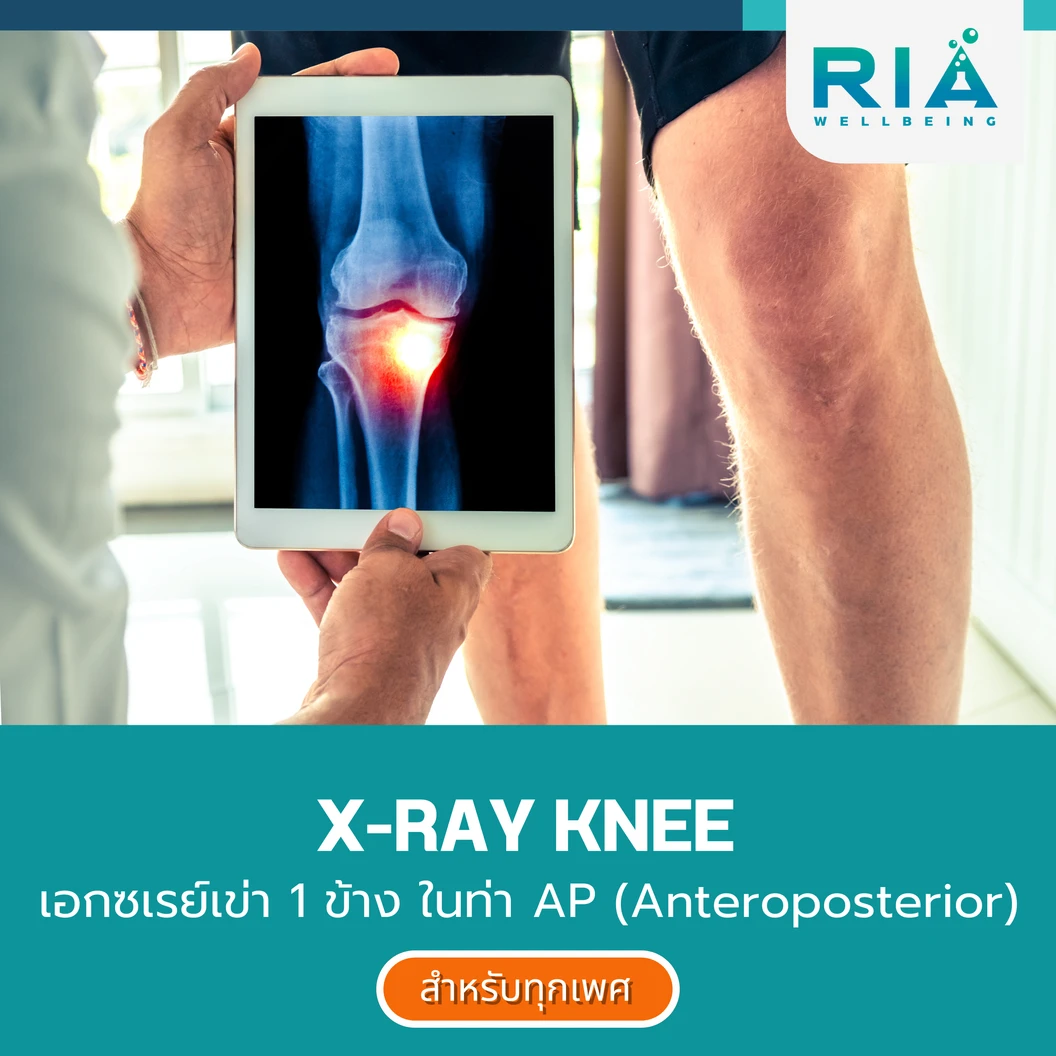 เอกซเรย์เข่า 1 ข้าง ในท่า AP (Anteroposterior)