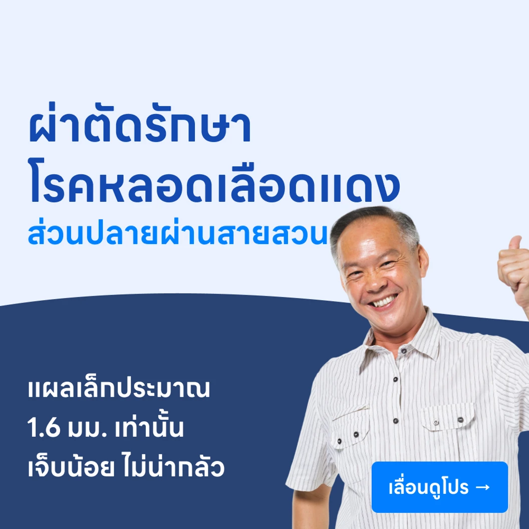 ผ่าตัดรักษาโรคหลอดเลือดแดงส่วนปลายผ่านสายสวน