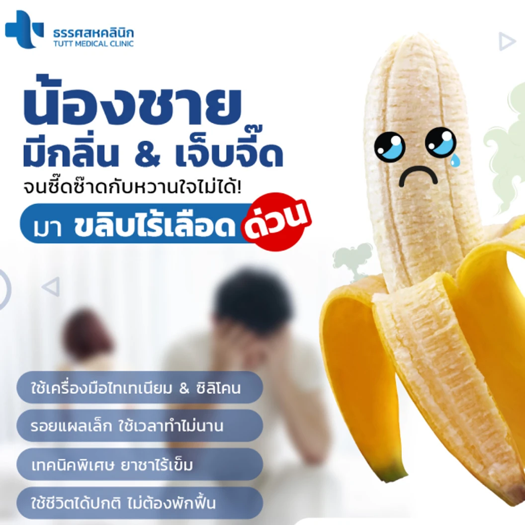 ขริบไร้เลือด ขริบปลายอวัยวะเพศชายด้วยเครื่องมือไทเทเนียมและซิลิโคน สำหรับผู้ที่อายุ 15 ปีขึ้นไป