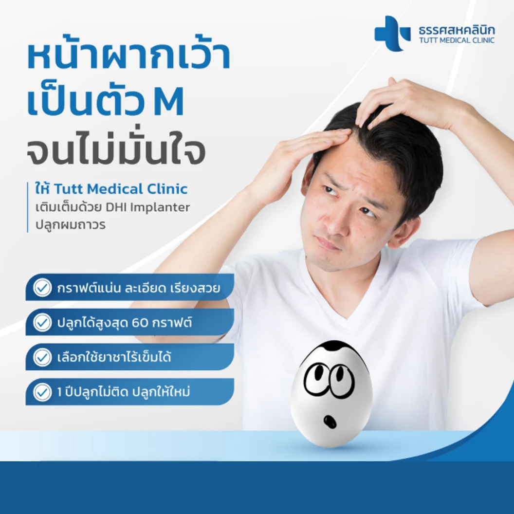 ปลูกผมถาวร ด้วยเทคนิค DHI ไม่จำกัดกราฟต์ 1 ครั้ง