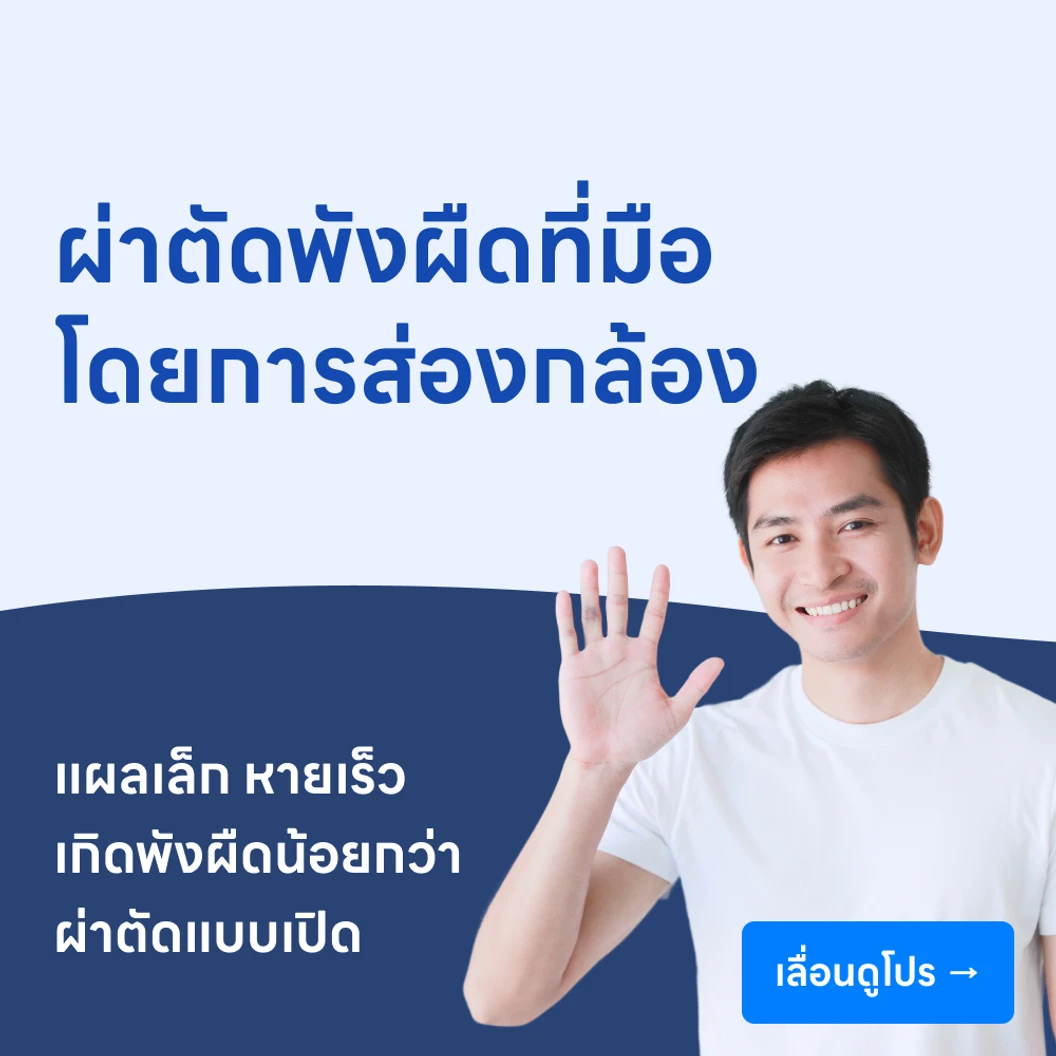 ผ่าตัดพังผืดที่มือโดยการส่องกล้อง