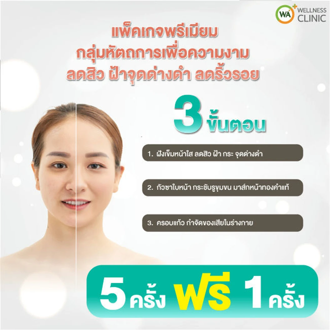 คอร์สฝังเข็ม ทำกัวซาหน้า และครอบแก้ว เพื่อปรับสภาพผิวให้ดูกระจ่างใส ลดริ้วรอย กระชับรูขุมขน 5 ครั้ง ฟรี! 1 ครั้ง