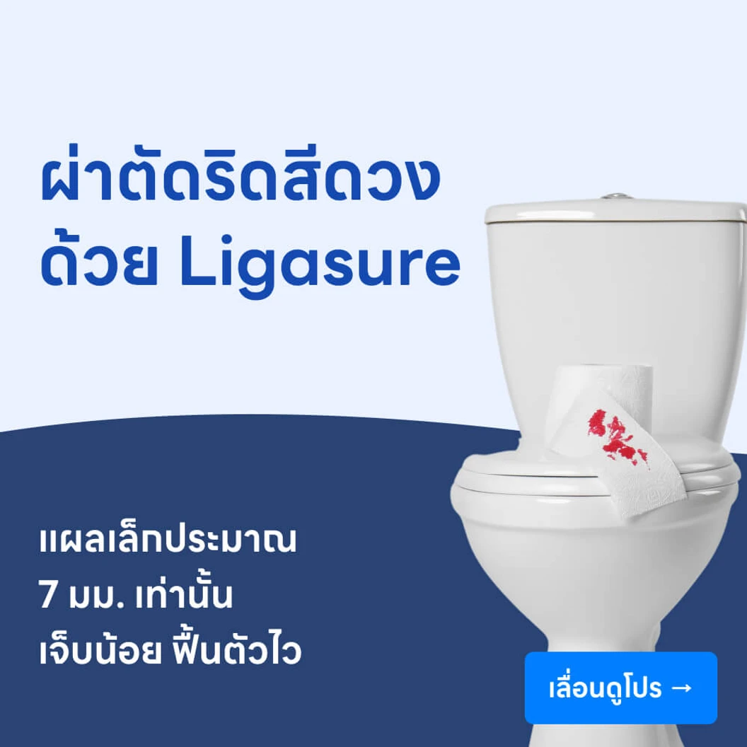 ผ่าตัดริดสีดวงทวารด้วยเครื่อง Ligasure