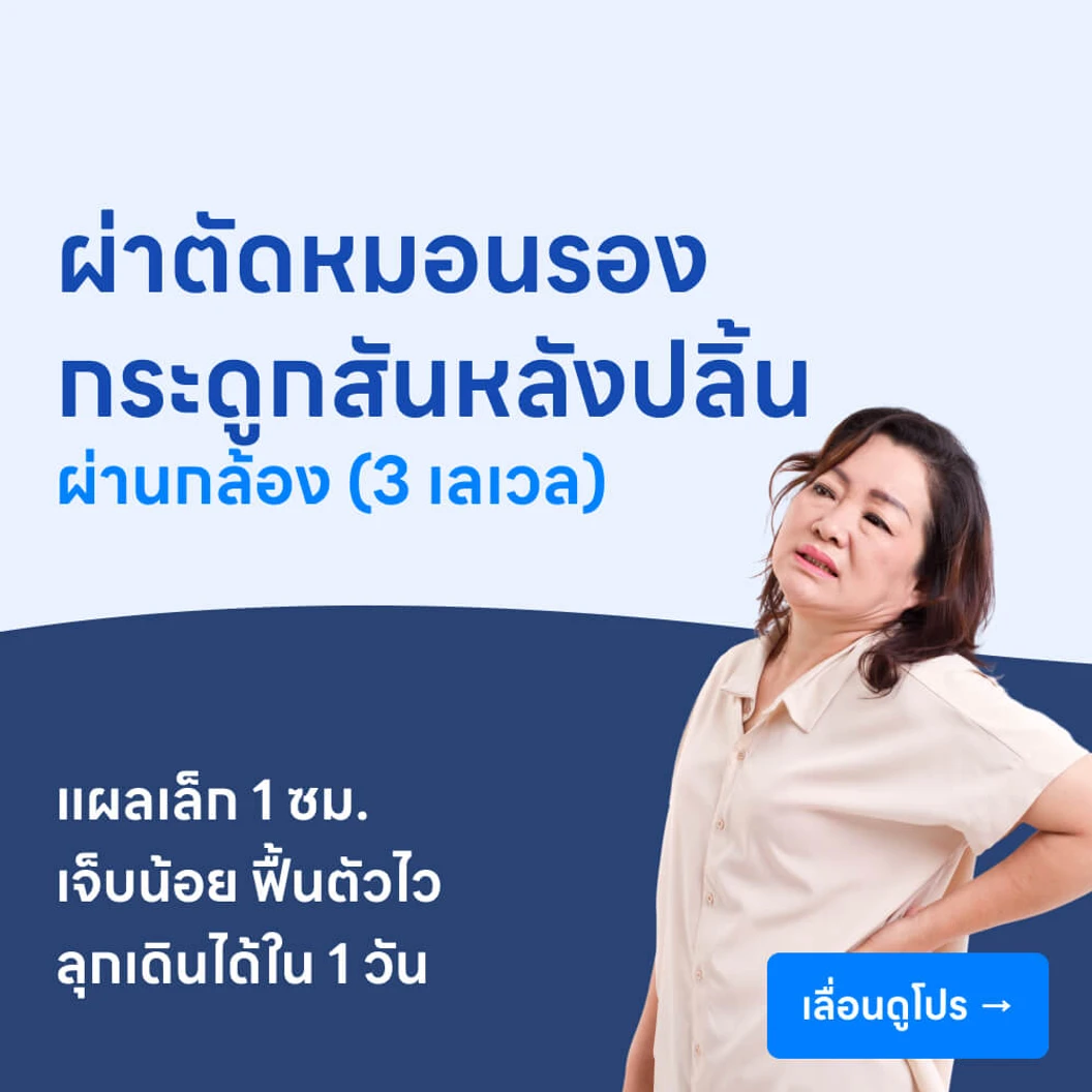 ผ่าตัดหมอนรองกระดูกสันหลังปลิ้นผ่านกล้องเอ็นโดสโคป (3 เลเวล)