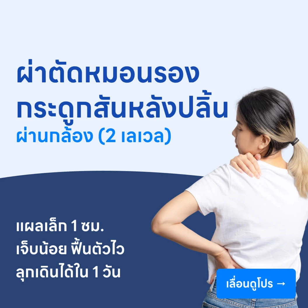 ผ่าตัดหมอนรองกระดูกสันหลังปลิ้นผ่านกล้องเอ็นโดสโคป (2 เลเวล)
