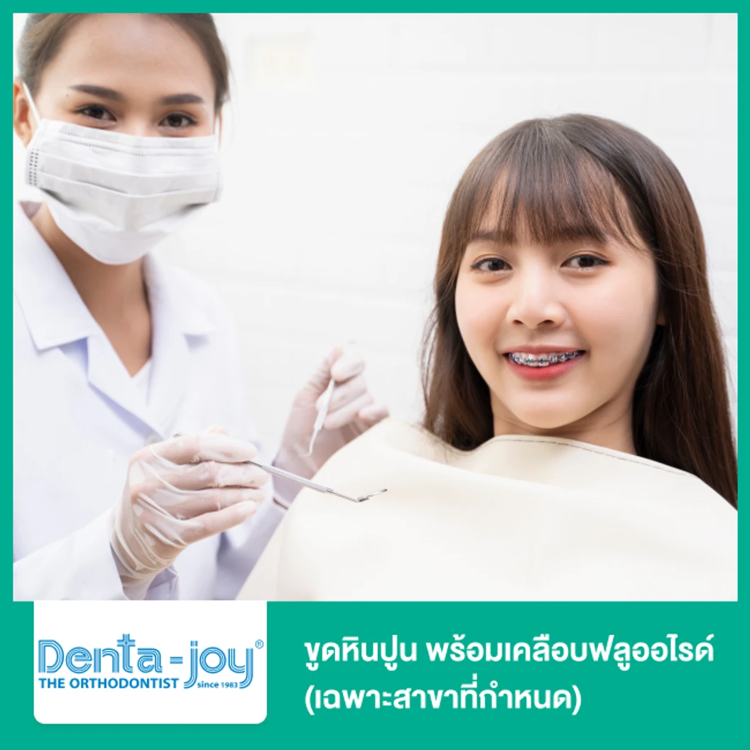 ขูดหินปูน พร้อมเคลือบฟลูออไรด์ (เฉพาะสาขาที่กำหนด)