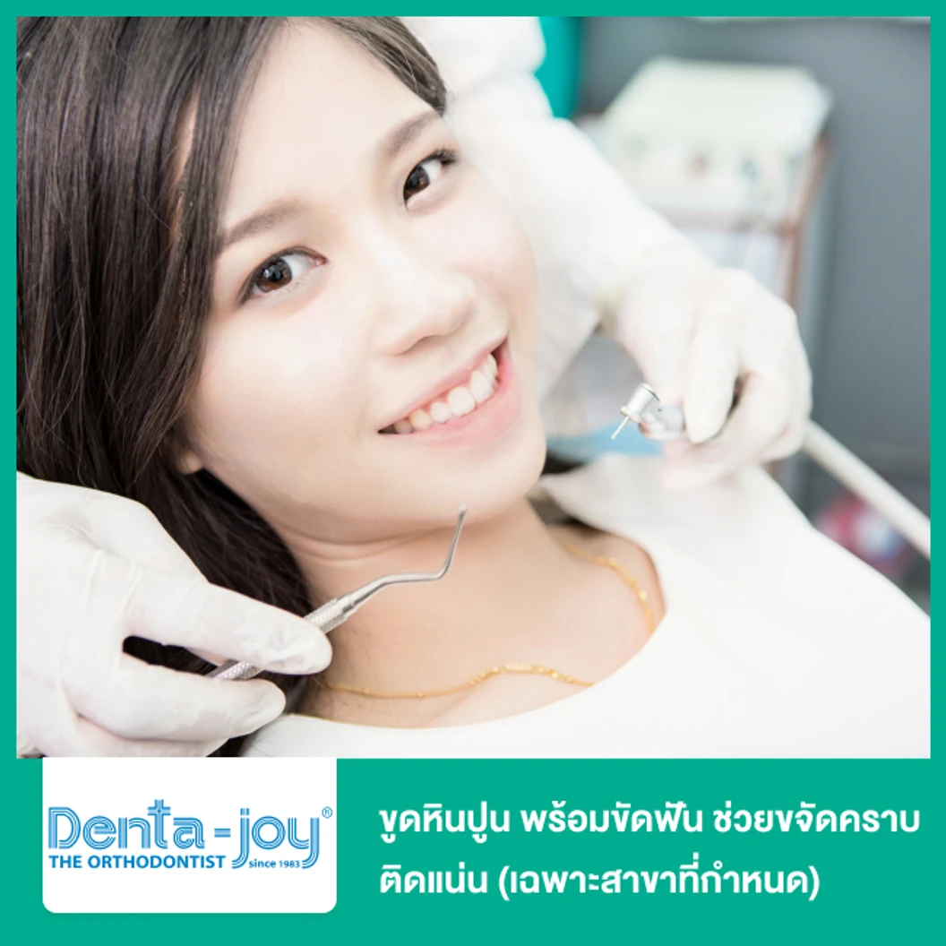 ขูดหินปูน พร้อมขัดฟันด้วยเครื่อง Airflow ช่วยขจัดคราบติดแน่น (เฉพาะสาขาที่กำหนด)