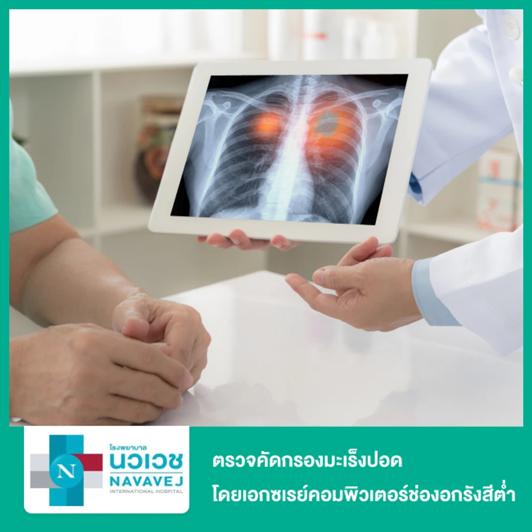 ตรวจคัดกรองมะเร็งปอด โดยเอกซเรย์คอมพิวเตอร์ช่องอกแบบใช้รังสีต่ำ (Dual Enegy Low Dose Chest CT Scan For Lung Cancer Screening)