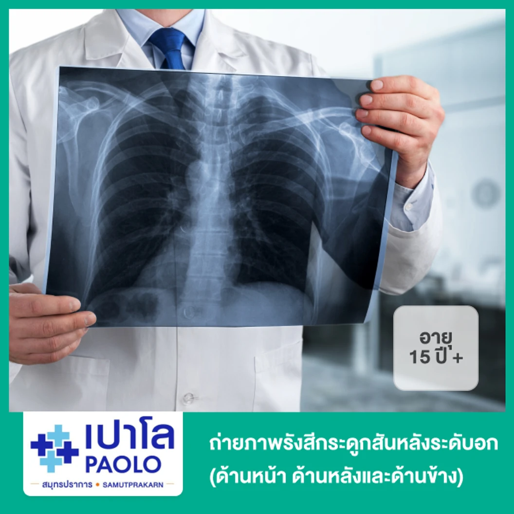ถ่ายภาพรังสีกระดูกสันหลังระดับอก (ด้านหน้า ด้านหลังและด้านข้าง) สำหรับผู้ที่อายุ 15 ปีขึ้นไป