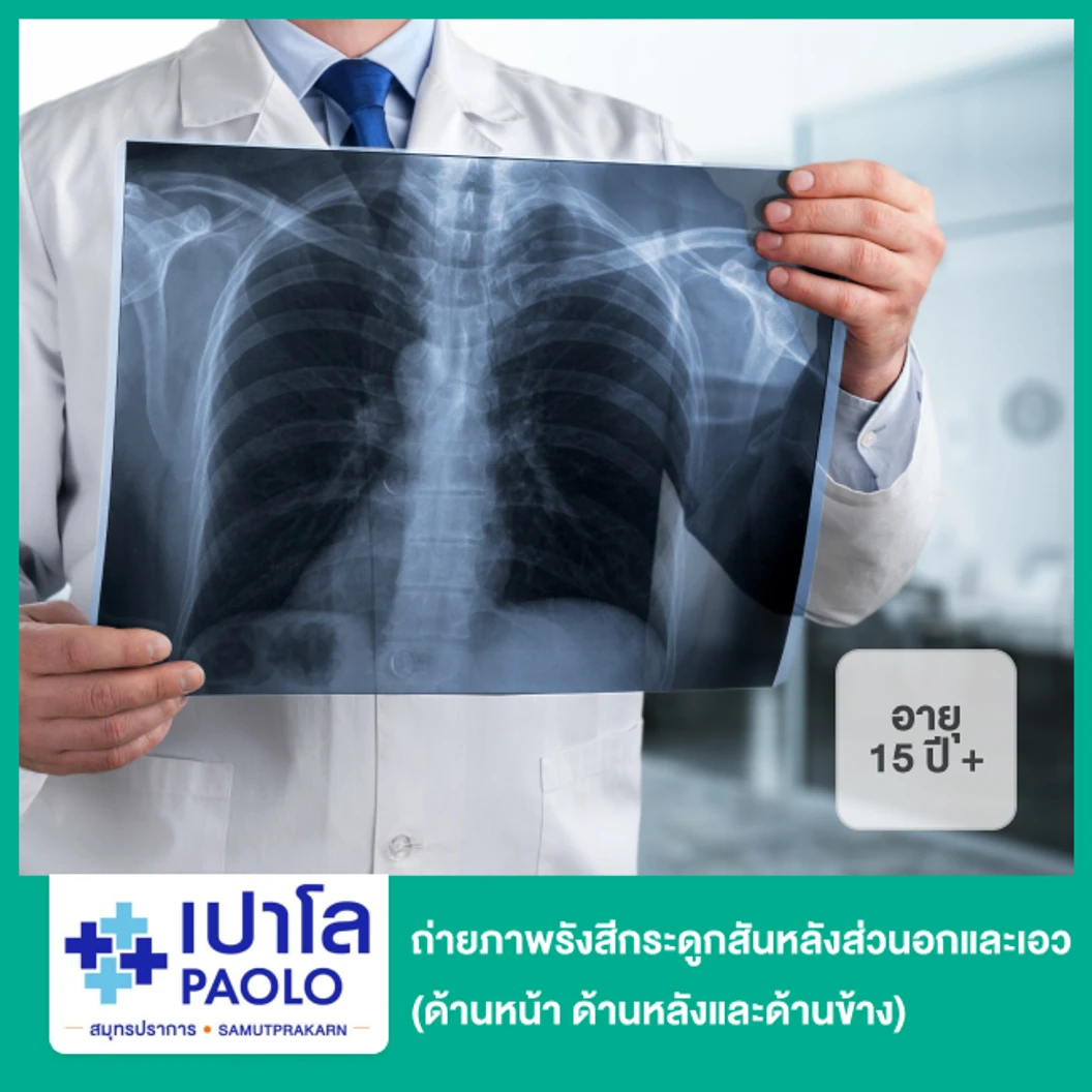 ถ่ายภาพรังสีกระดูกสันหลังส่วนอกและเอว (ด้านหน้า ด้านหลังและด้านข้าง) สำหรับผู้ที่อายุ 15 ปีขึ้นไป
