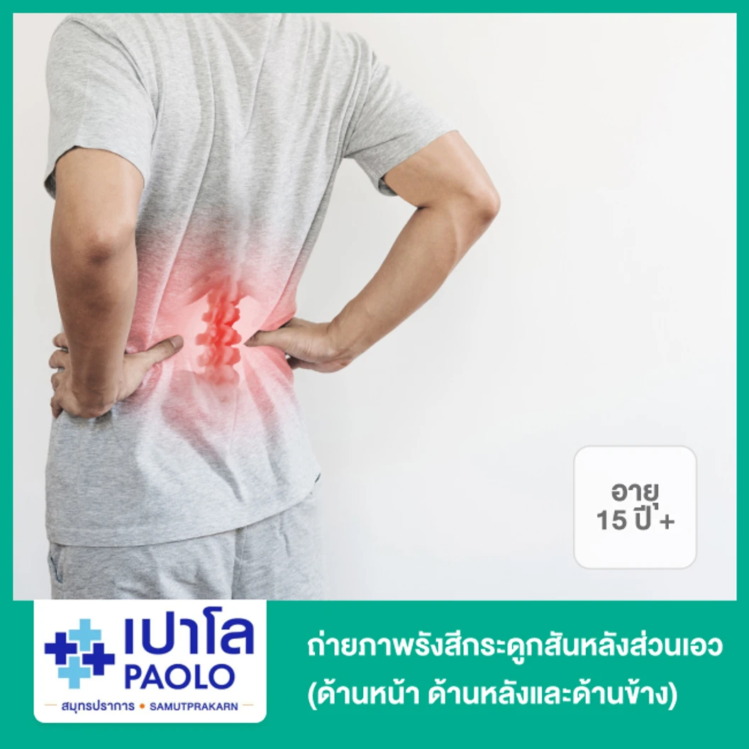 ถ่ายภาพรังสีกระดูกสันหลังส่วนเอว (ด้านหน้า ด้านหลังและด้านข้าง) สำหรับผู้ที่อายุ 15 ปีขึ้นไป