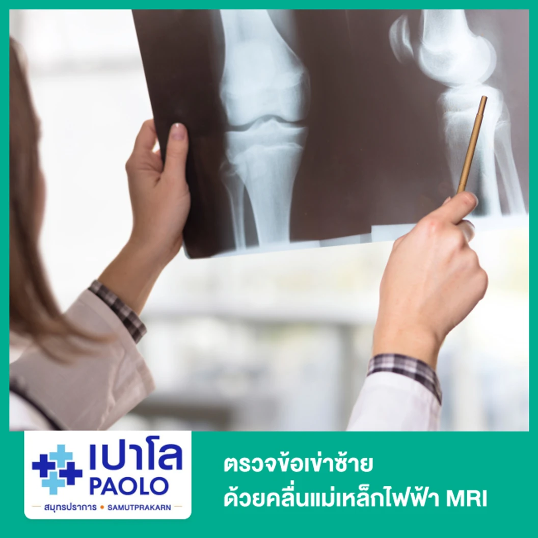 ตรวจข้อเข่าซ้าย ด้วยคลื่นแม่เหล็กไฟฟ้า (MRI LT Knee)