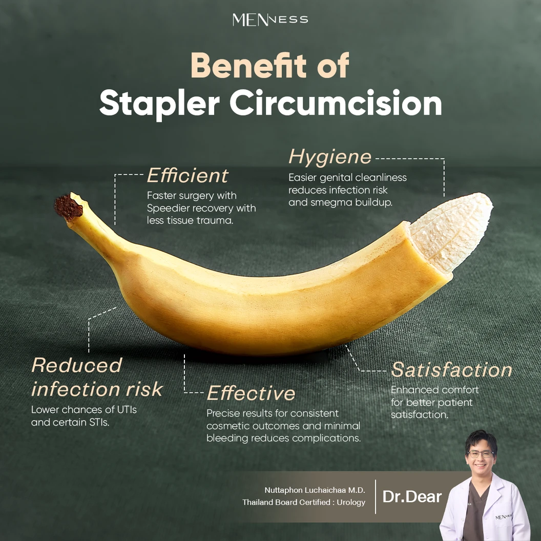 ขริบไร้เลือด ขริบปลายอวัยวะเพศชายด้วยเครื่องมือไทเทเนียม