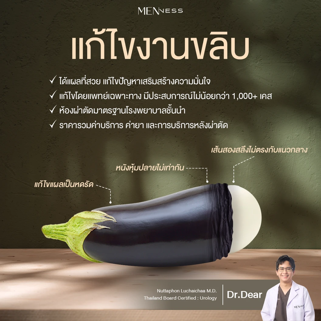 ผ่าตัดขริบแก้ไขหนังหุ้มปลายอวัยวะเพศชาย สำหรับเคสแก้
