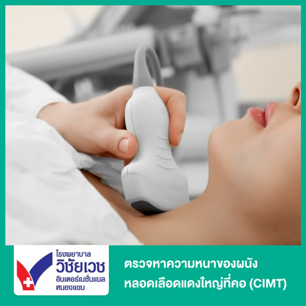อัลตราซาวด์หลอดเลือดใหญ่ที่คอ (Carotid Doppler Ultrasound)