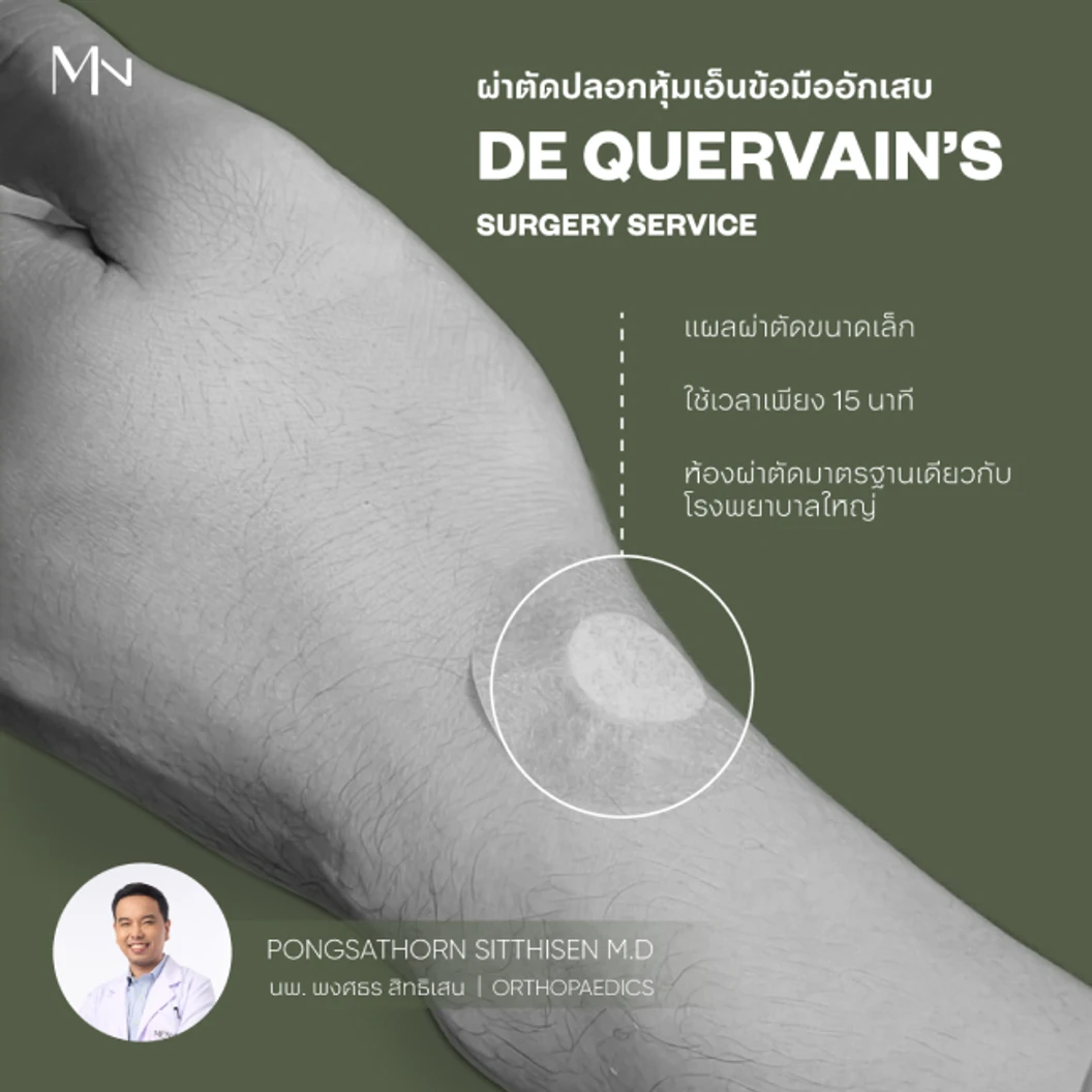 ผ่าตัดโรคปลอกหุ้มเอ็นนิ้วอักเสบ (De Quervain's Disease)