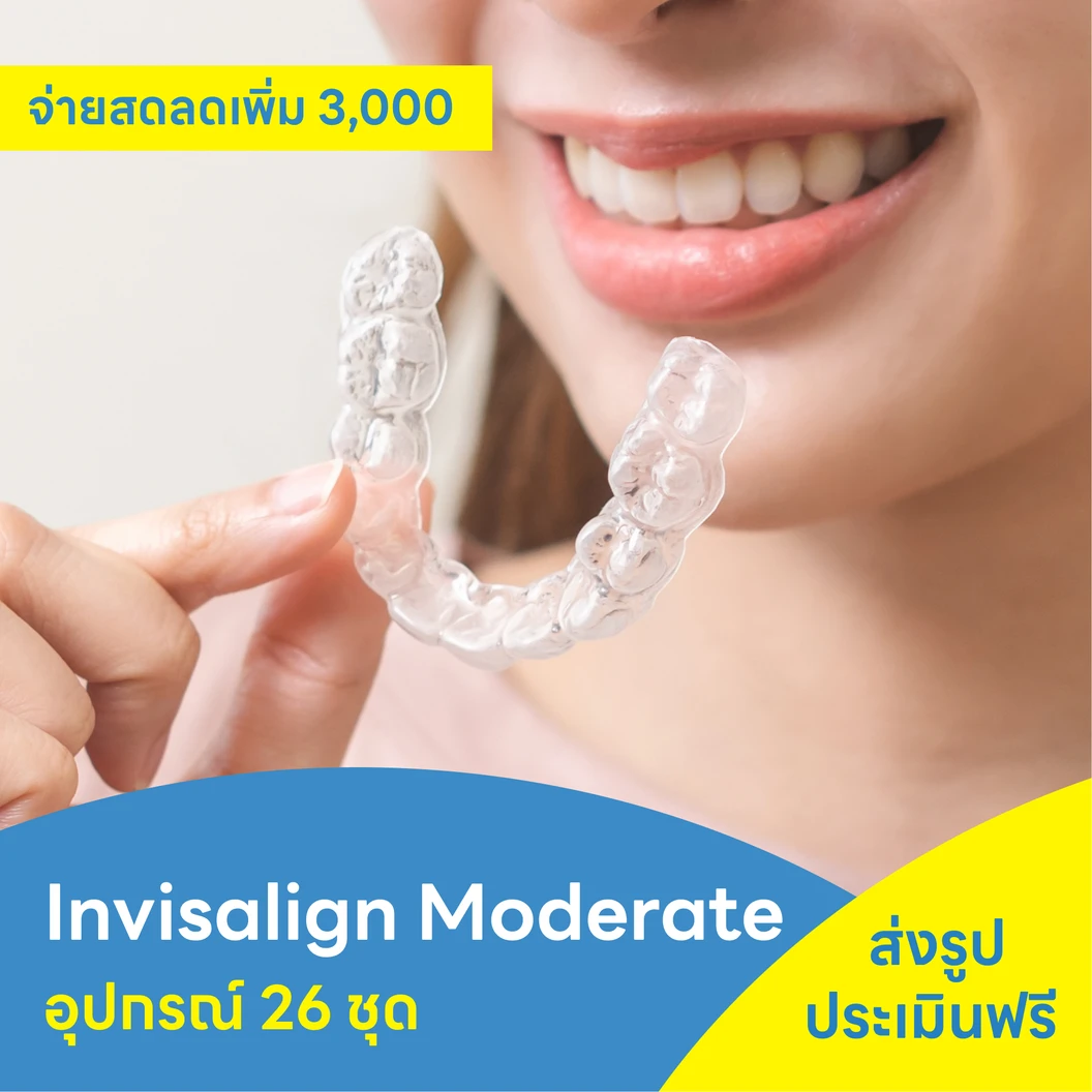 จัดฟันแบบใส Invisalign Moderate ฟันบนและล่าง ที่ Smile Design Dental ...