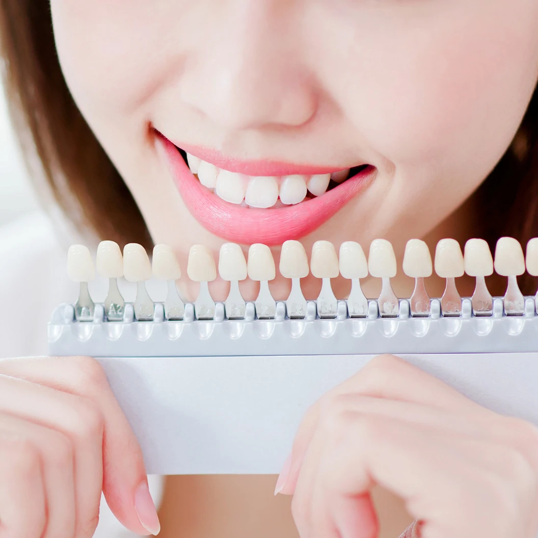 ฟอกสีฟันที่คลินิก ด้วยระบบ Cool Light