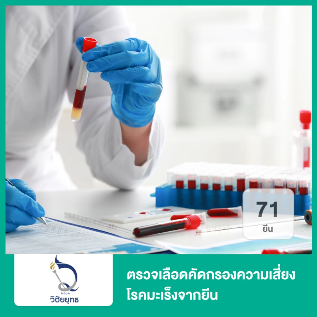 ตรวจเลือดคัดกรองความเสี่ยงโรคมะเร็งจากยีน จำนวน 133 ยีน