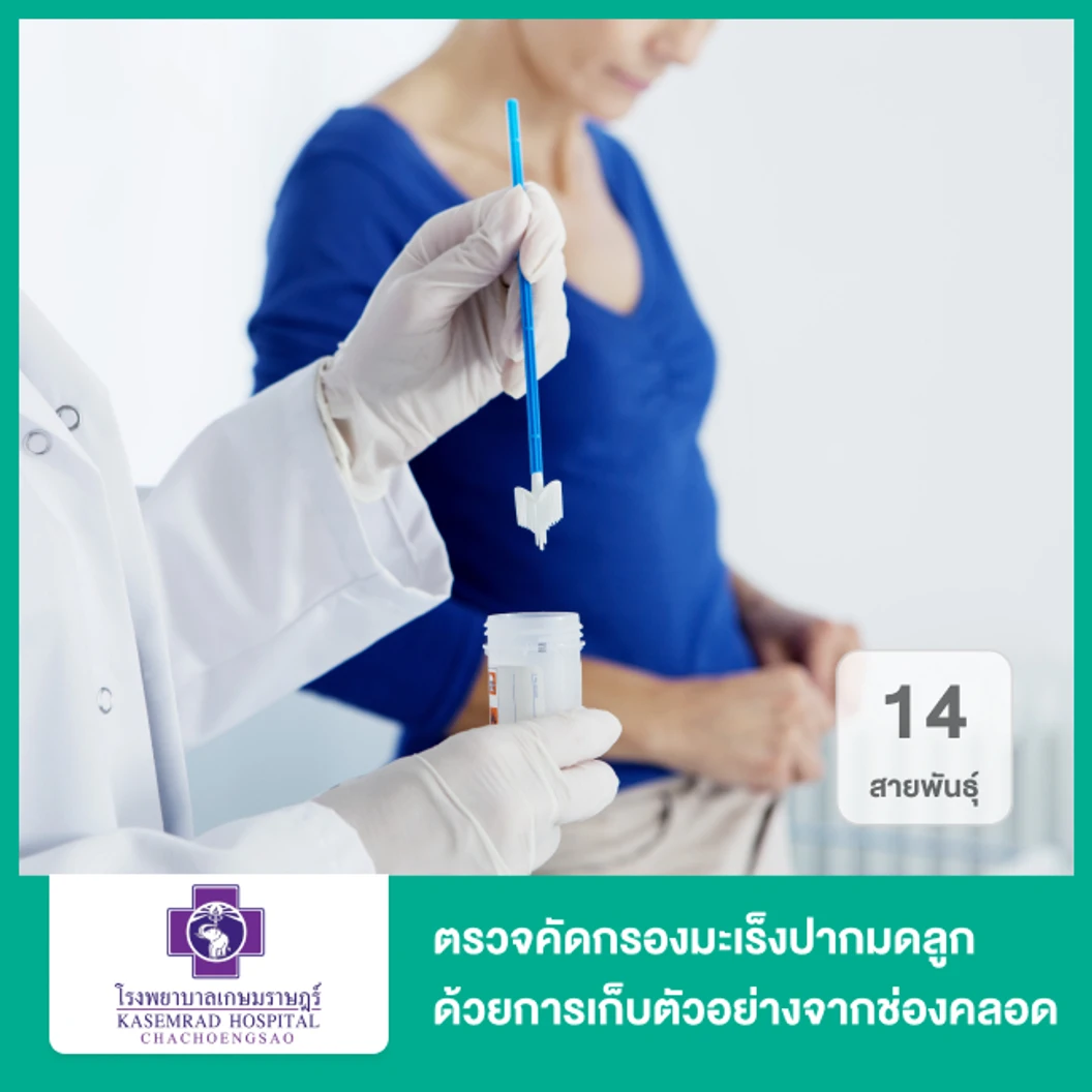ตรวจคัดกรองมะเร็งปากมดลูก ด้วยวิธี HPV DNA Test 14 สายพันธุ์ ด้วยการเก็บตัวอย่างจากช่องคลอดด้วยตัวเอง