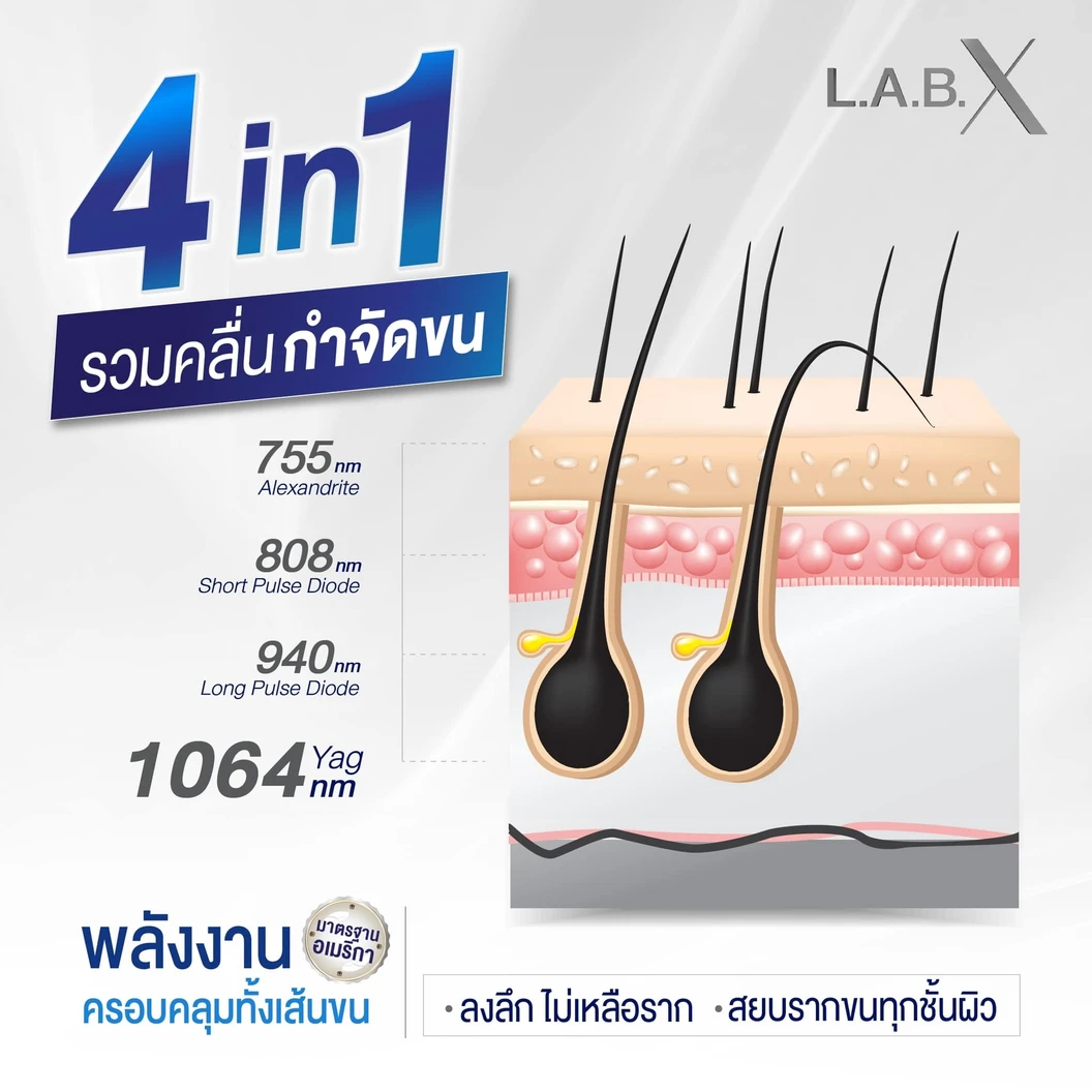 กำจัดขนทั่วแผ่นหลัง ด้วยเลเซอร์ 4 พลังงาน 1 ครั้ง ฟรี! 1 ครั้ง สำหรับผู้หญิงหรือผู้ชาย
