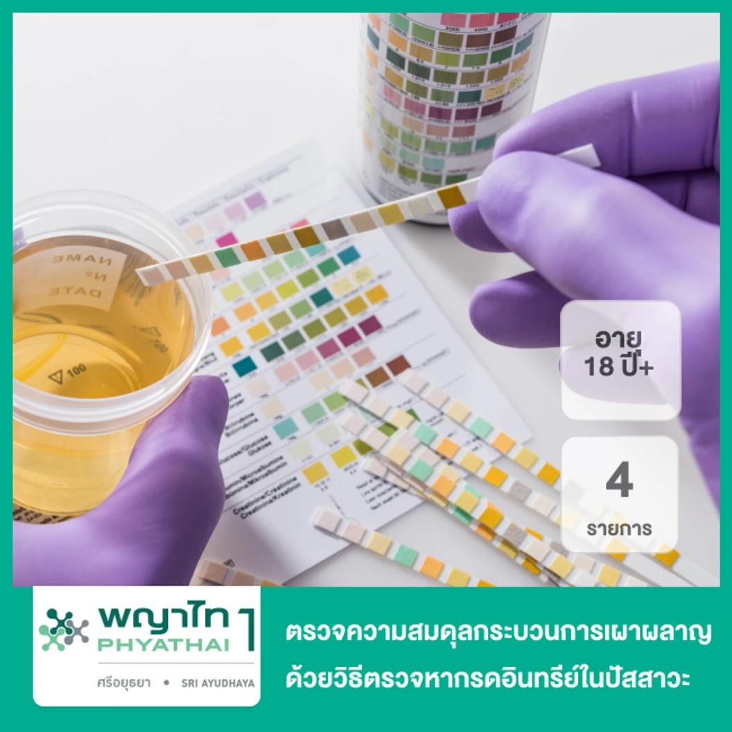 ตรวจความสมดุลกระบวนการเผาผลาญ ด้วยวิธีตรวจหากรดอินทรีย์ในปัสสาวะ 4 รายการ สำหรับผู้ที่อายุ 18 ปีขึ้นไป