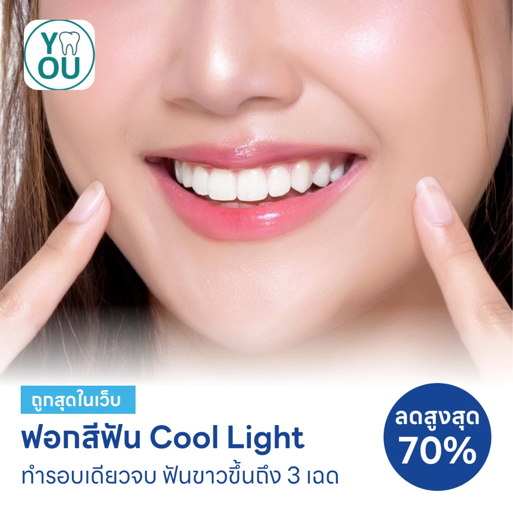 ฟอกสีฟันที่คลินิก ด้วยระบบ Cool Light