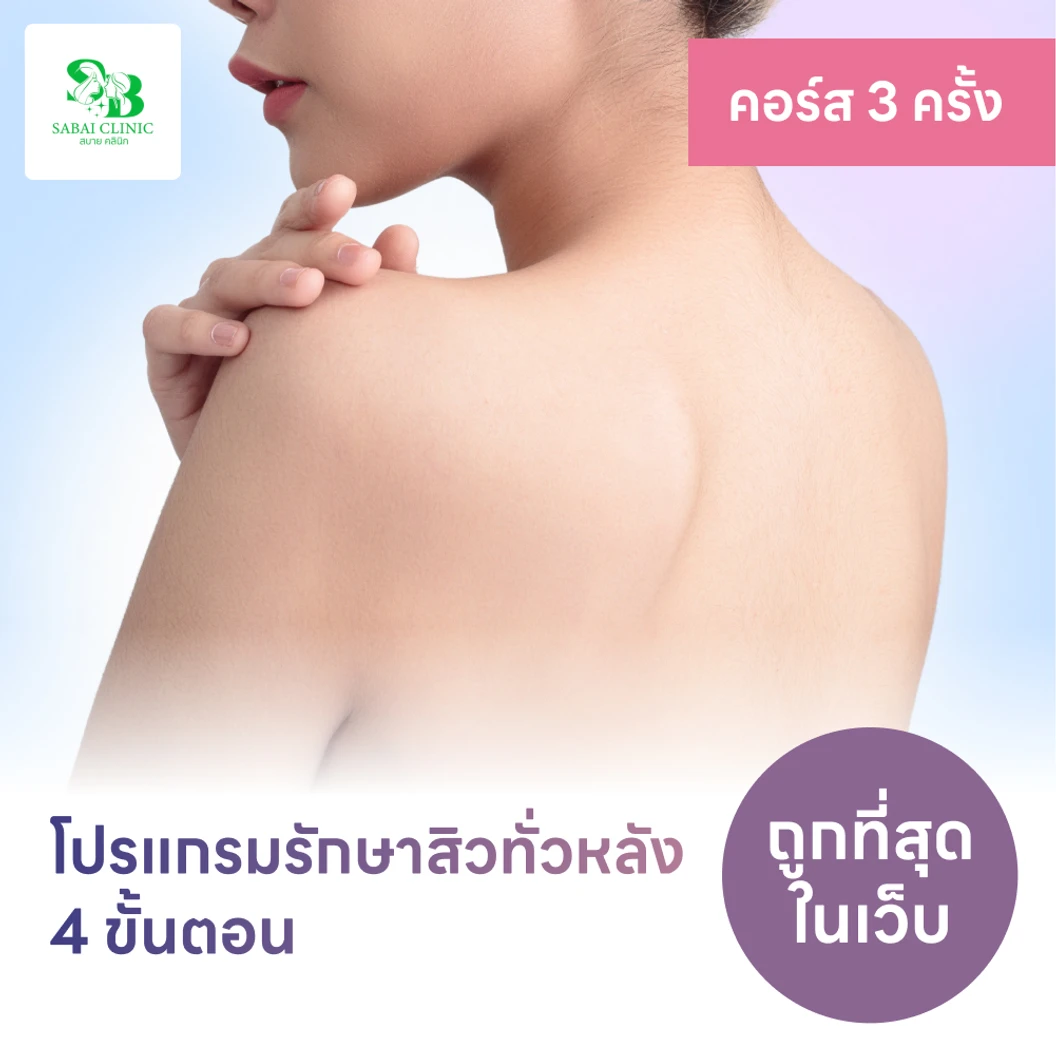คอร์สโปรแกรมรักษาสิวทั่วแผ่นหลัง 4 ขั้นตอน 2 ครั้ง ฟรี! 1 ครั้ง