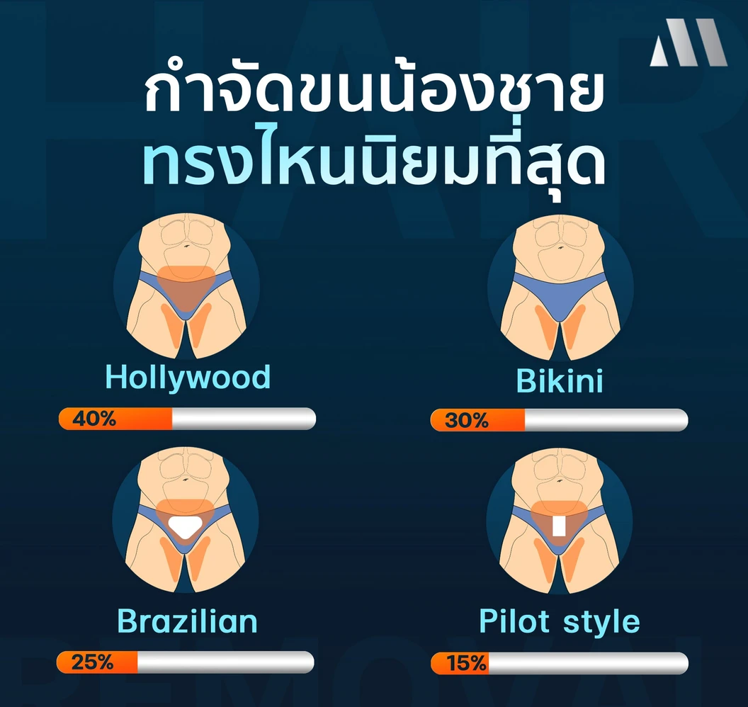 กำจัดขน Bikini ด้วย Ai Laser 1 ครั้ง สำหรับผู้ชายเท่านั้น
