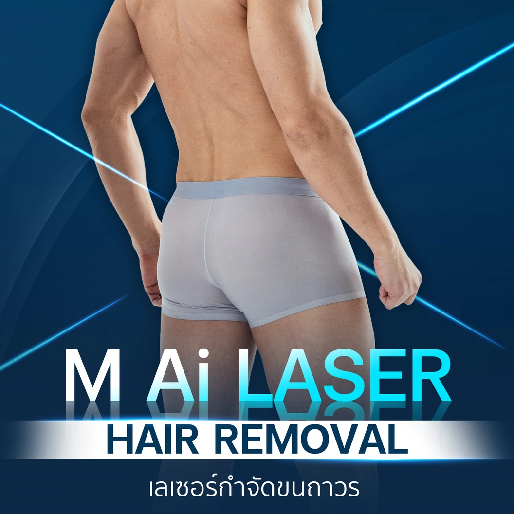 กำจัดขน Bikini ด้วย Ai Laser 1 ครั้ง สำหรับผู้ชายเท่านั้น